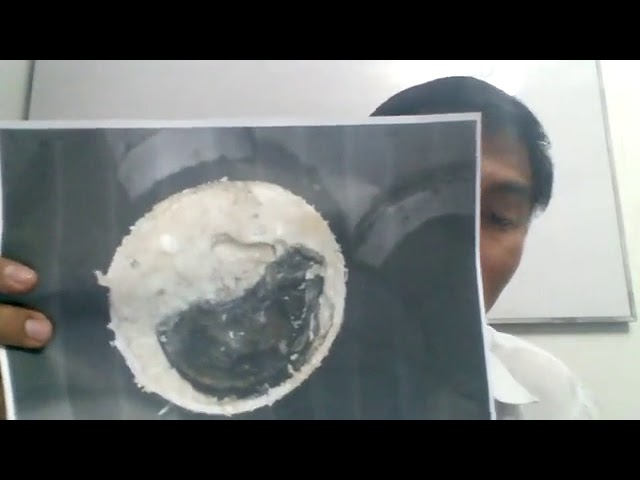 ¿Por qué sucede cómo evitar obstrucciones en desagües industriales y cómo evitarlo?