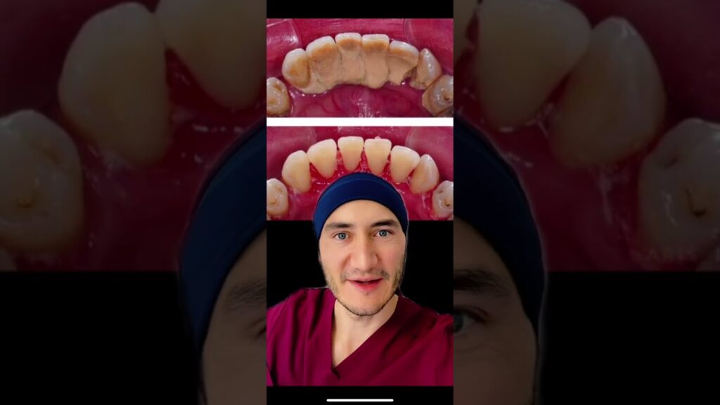 Casos reales de problemas por consecuencias de no seguir un protocolo de limpieza